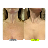 LED Esthetics Glotech™ Mask Pro + Collar
