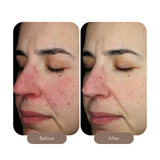 Intense Serum