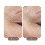 Intense Serum