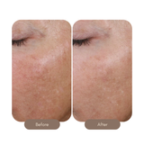 AlphaRet Overnight Cream