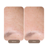 AlphaRet Overnight Cream
