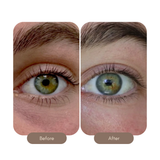 Eye Serum