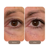 Eye Serum