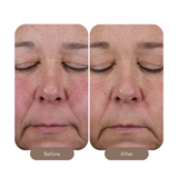 Mystro Active Balance Serum