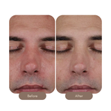 Mystro Active Balance Serum