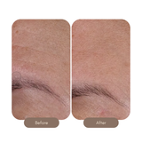 Wrinkle + Texture 0.3%