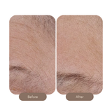 Wrinkle + Texture 0.3%