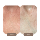 Body Serum